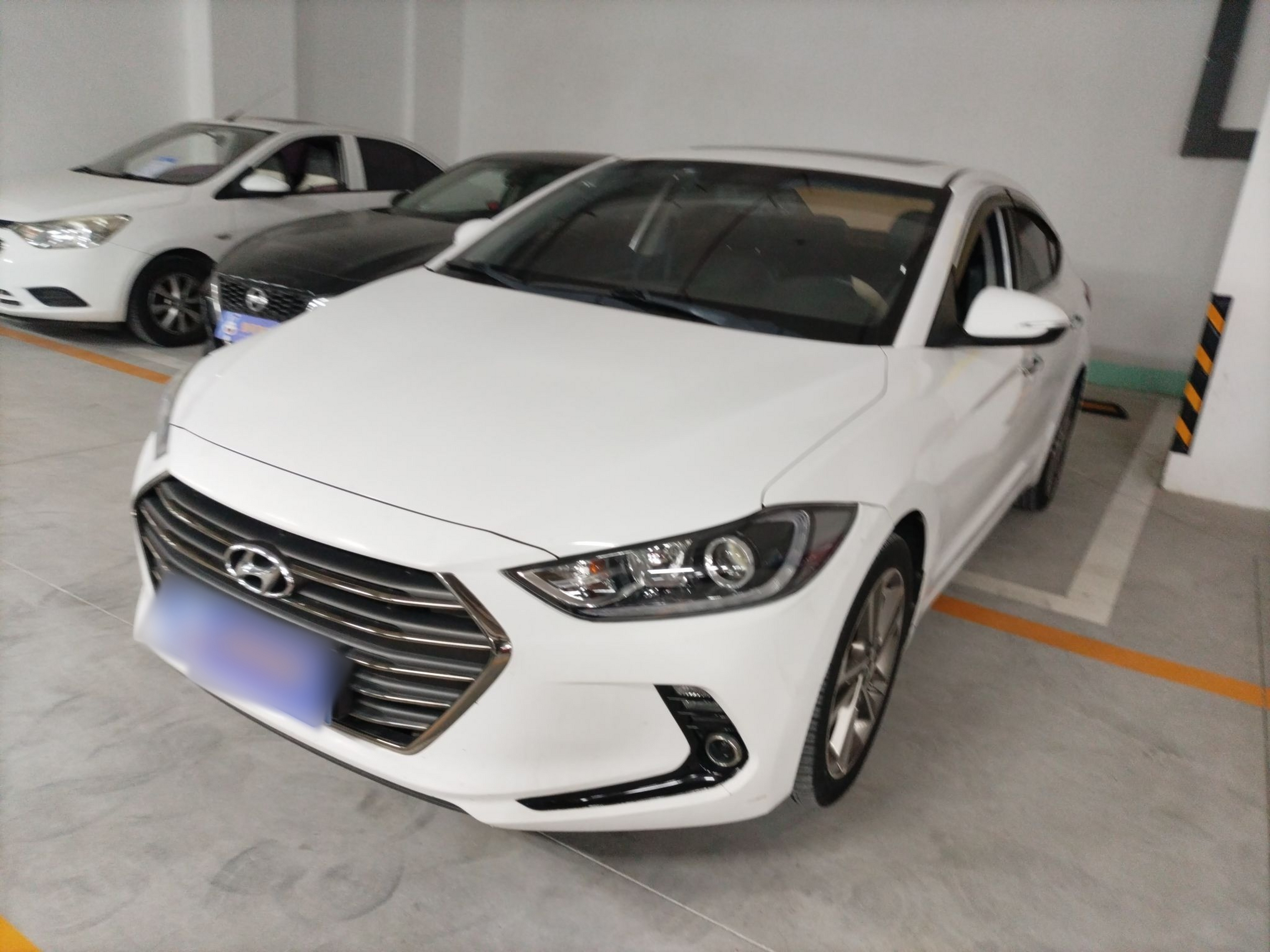 تحت مقدمة السيارة