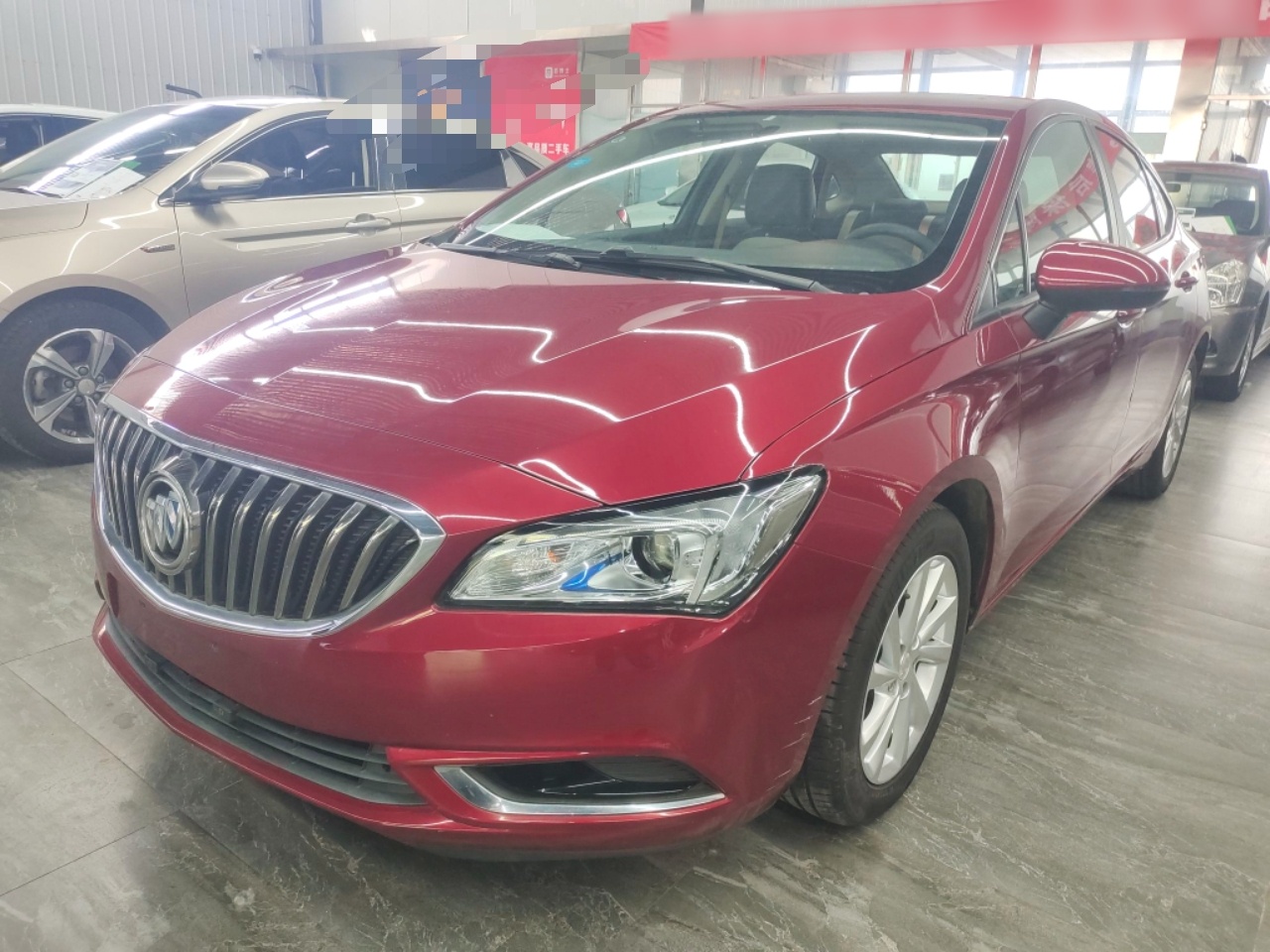 Parte inferior delantera