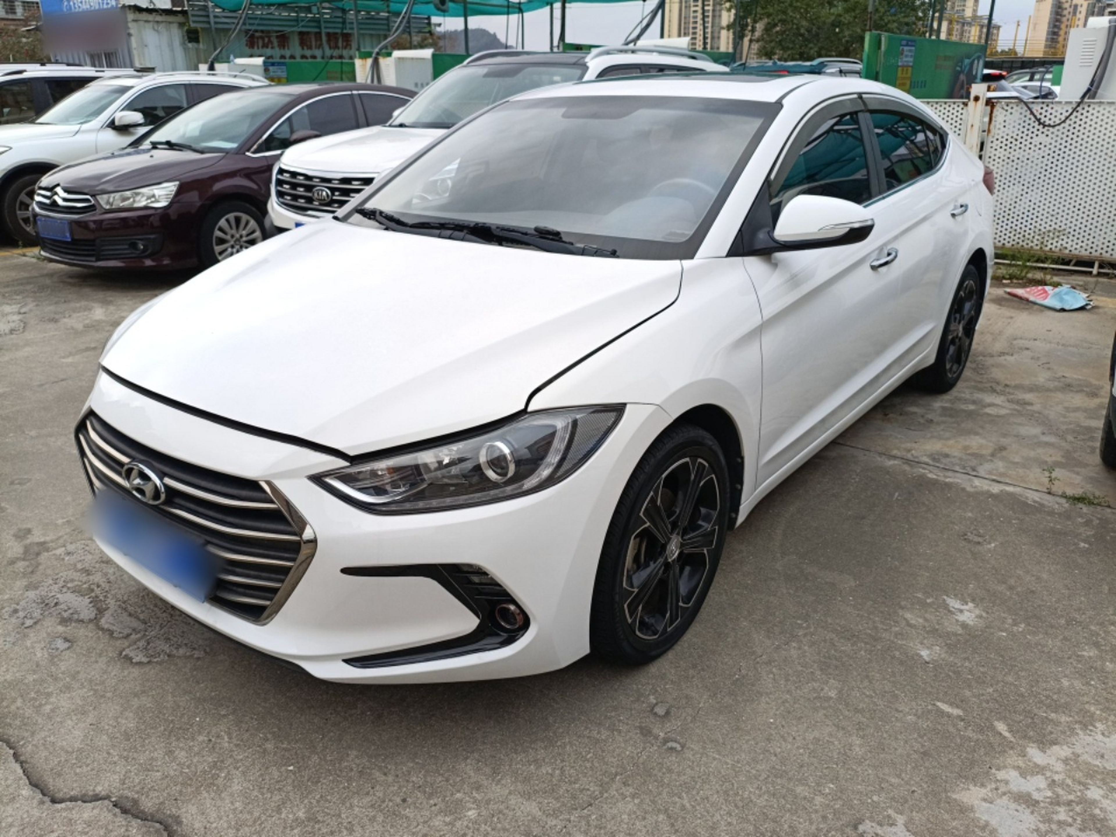 تحت مقدمة السيارة