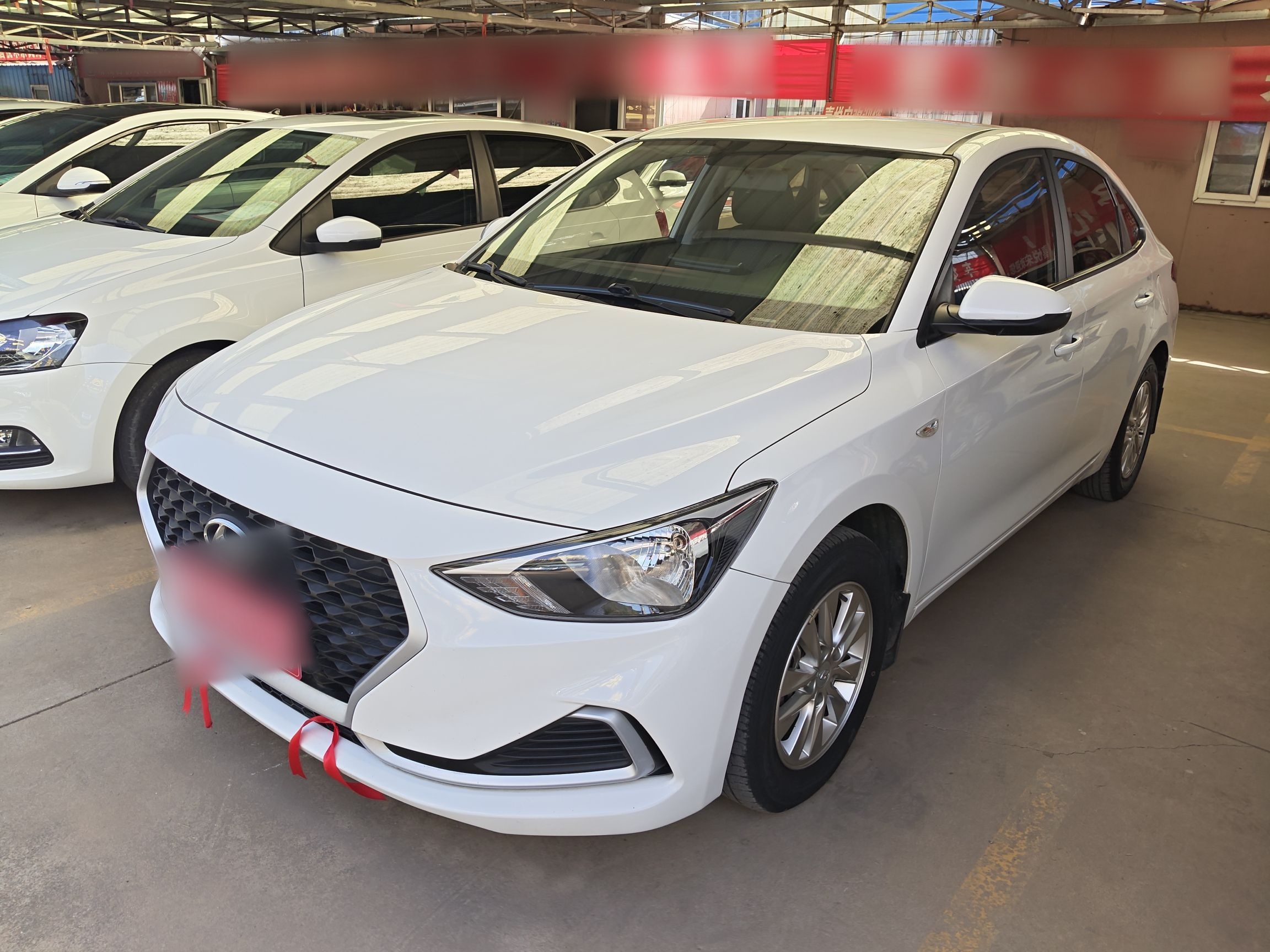 Parte inferior delantera