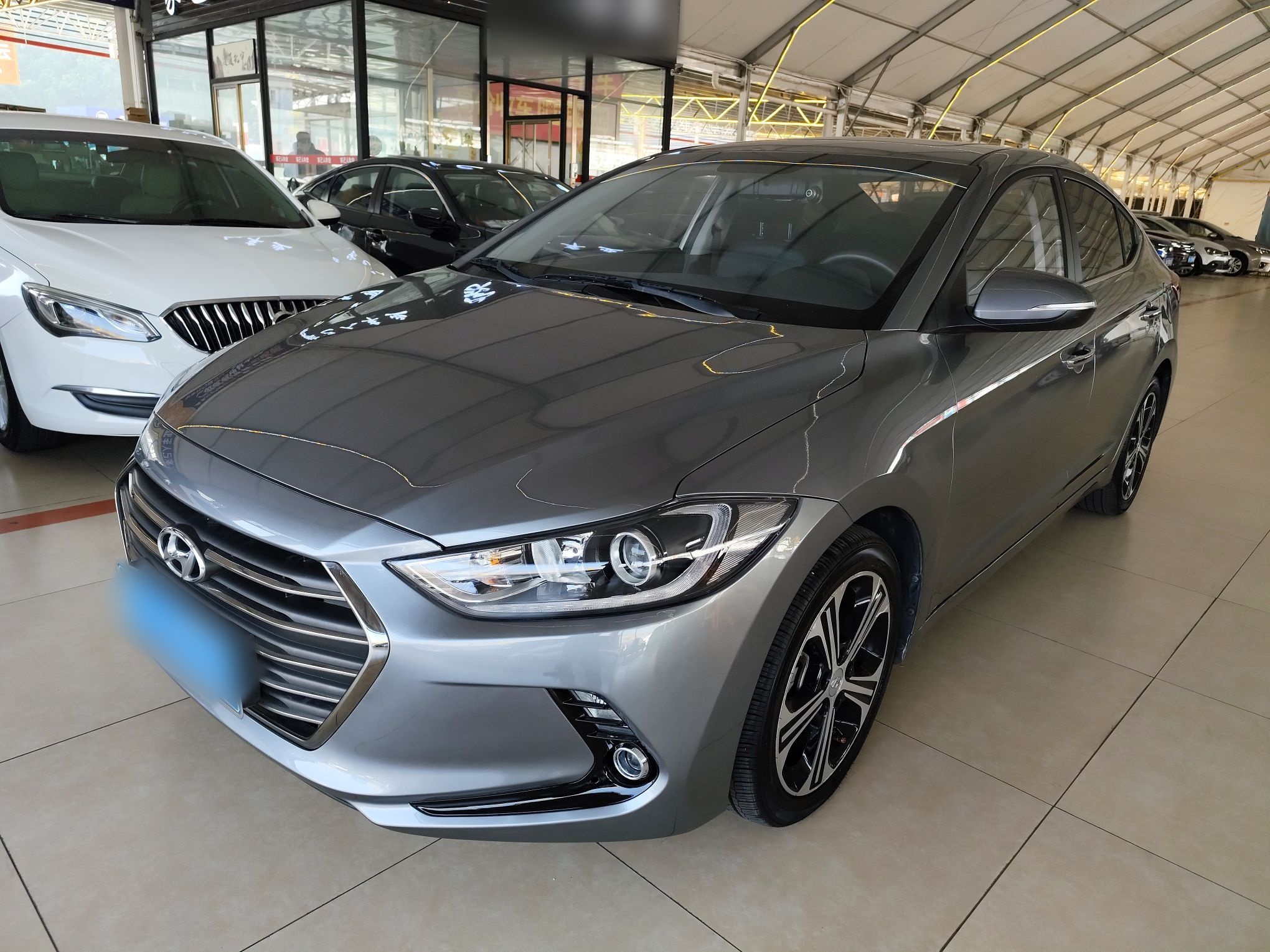 تحت مقدمة السيارة